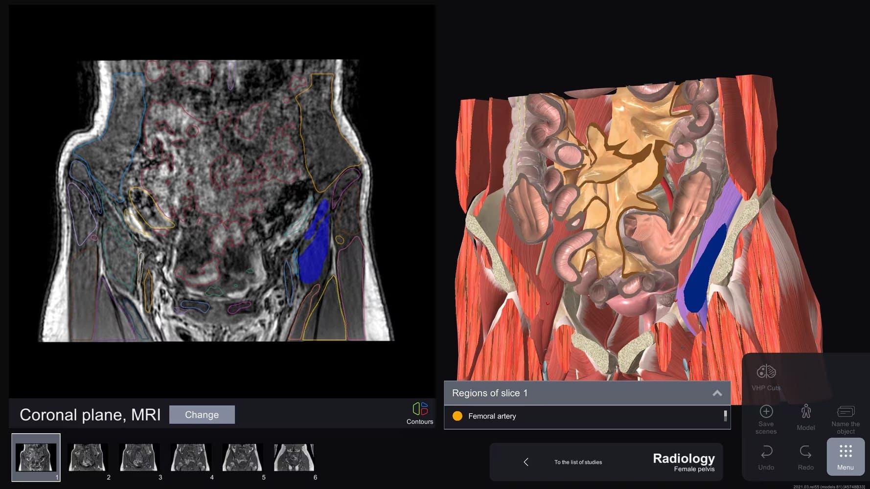 Visual perception of the material with the Anatomy app