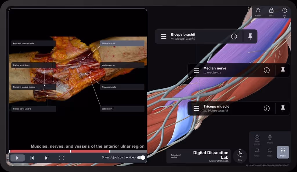 The best anatomy app for medical students Anatomy Table — S Vision