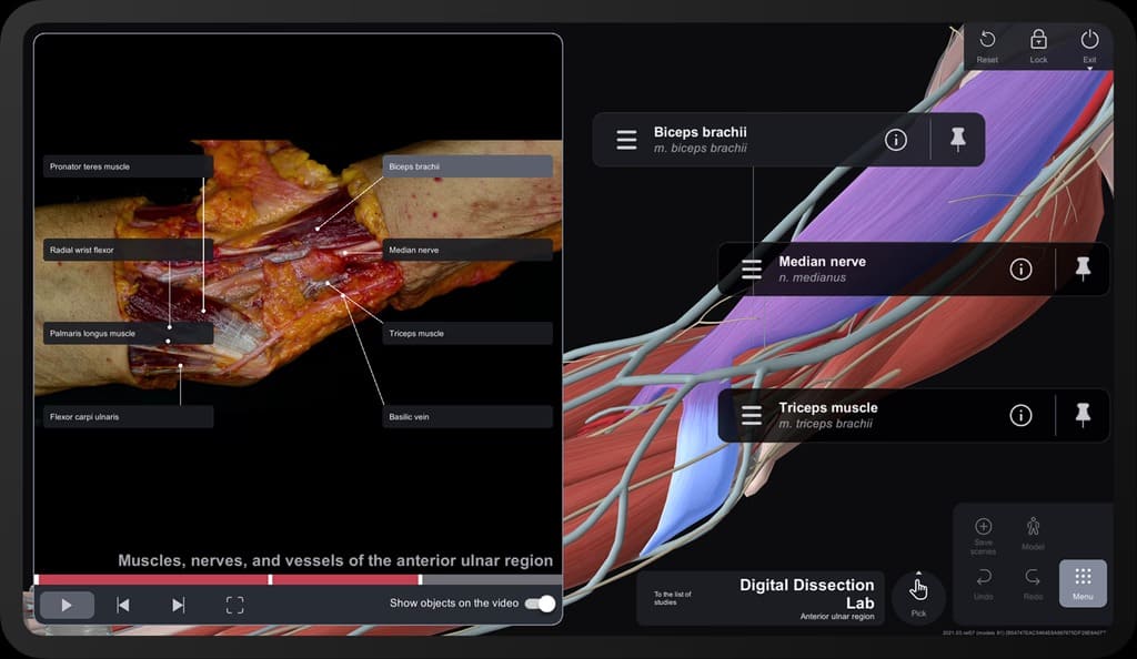 The best anatomy app for medical students Anatomy Table — S Vision