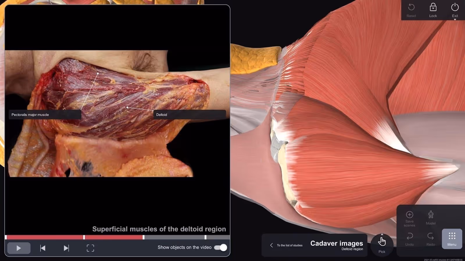 VR for Anatomy Education