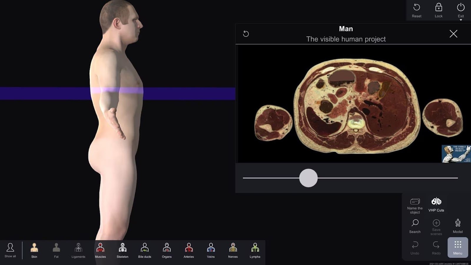 3D reconstruction of MRI data on Anatomy Table — S Vision