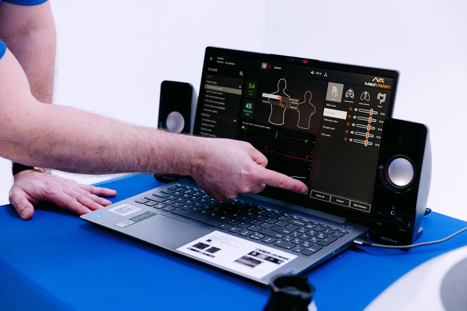 Monitoring of heart rate changes