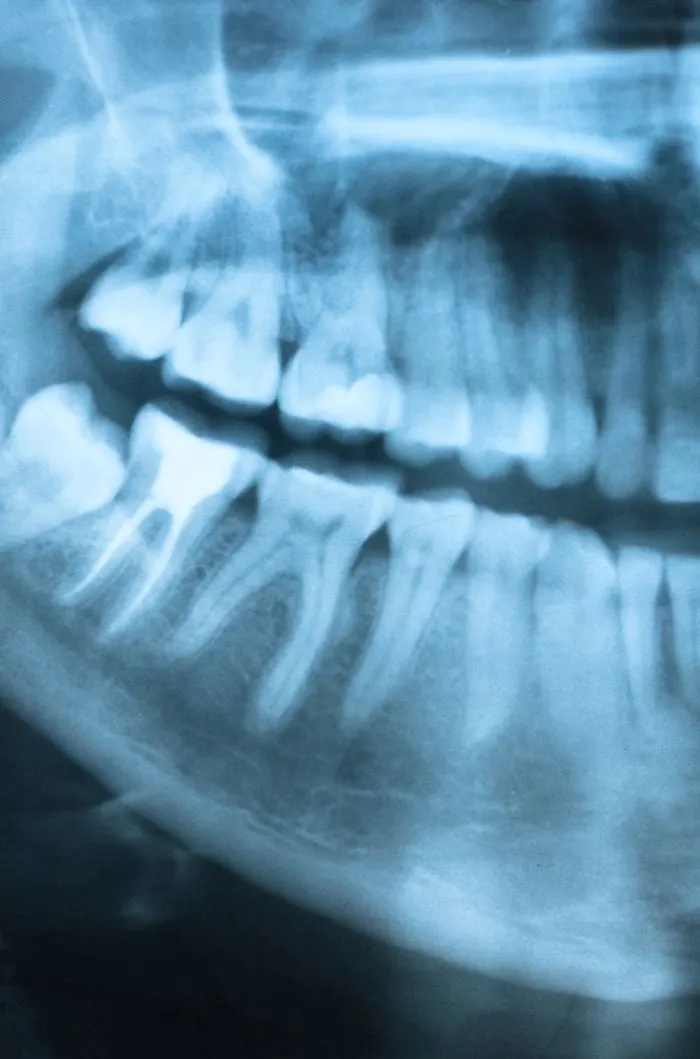 Digital X-Rays & Imaging