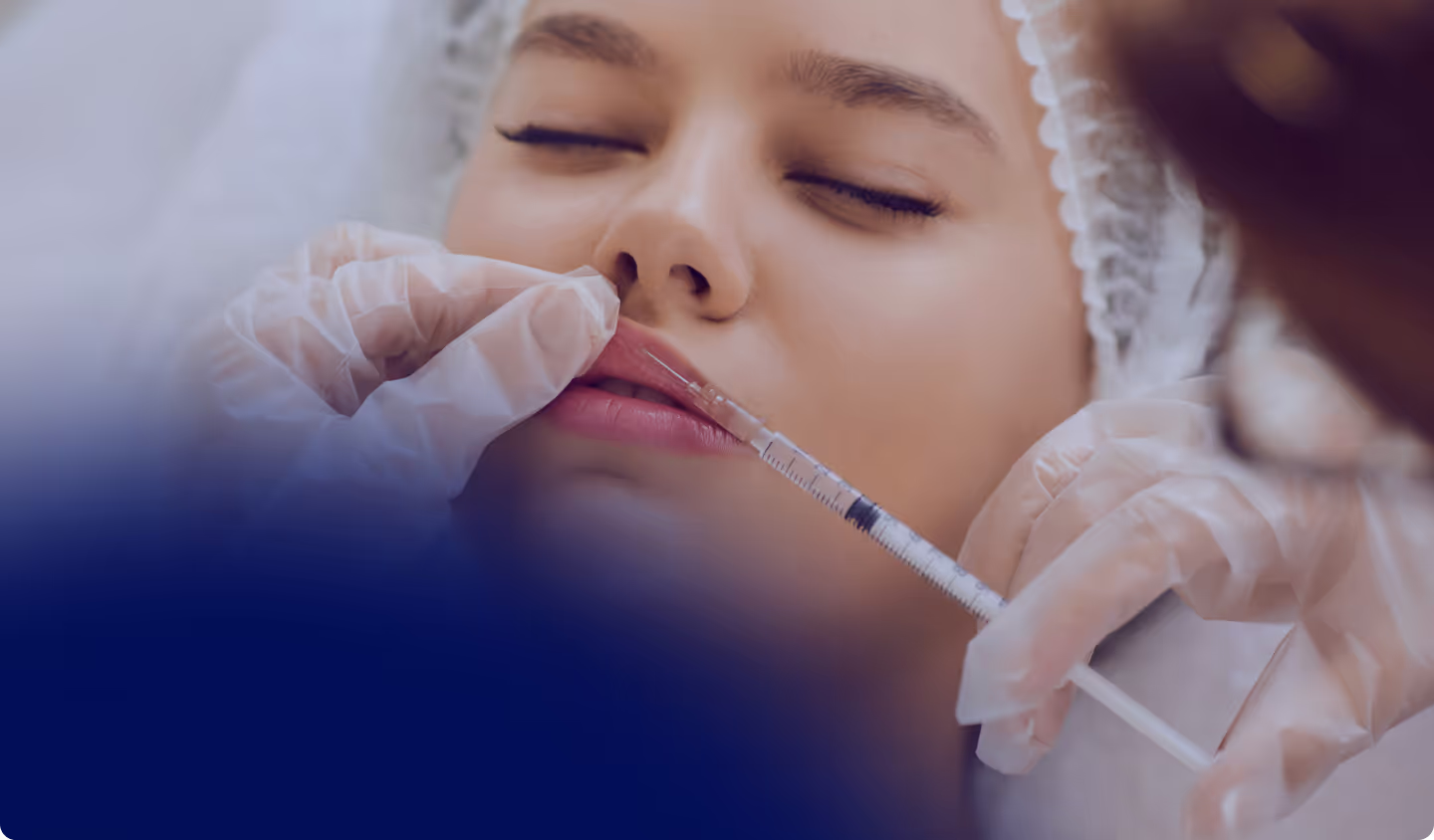 The Perfect Lip - Achieving Balance, Volume, and Natural Lip Enhancement
