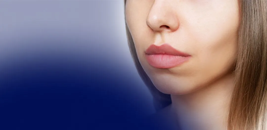 M-Shaped Lips: Best Lip Fillers and Techniques to Perfect Them