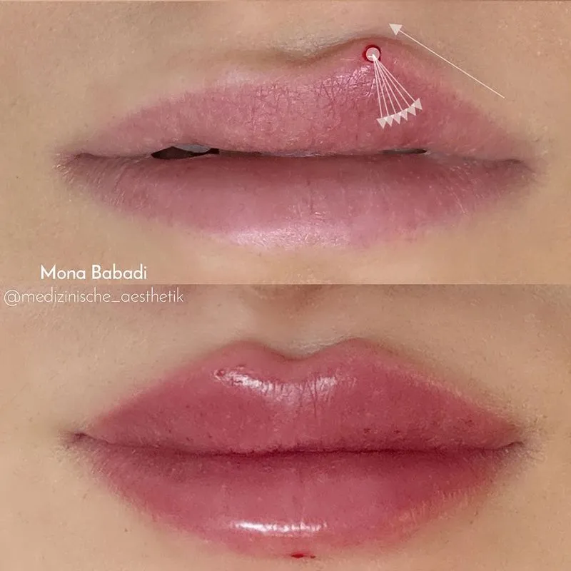 russian lip technique