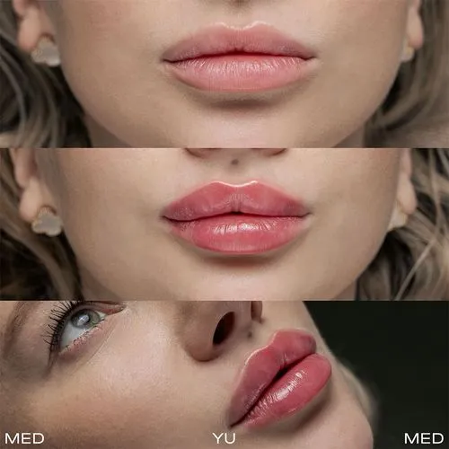 russian lips