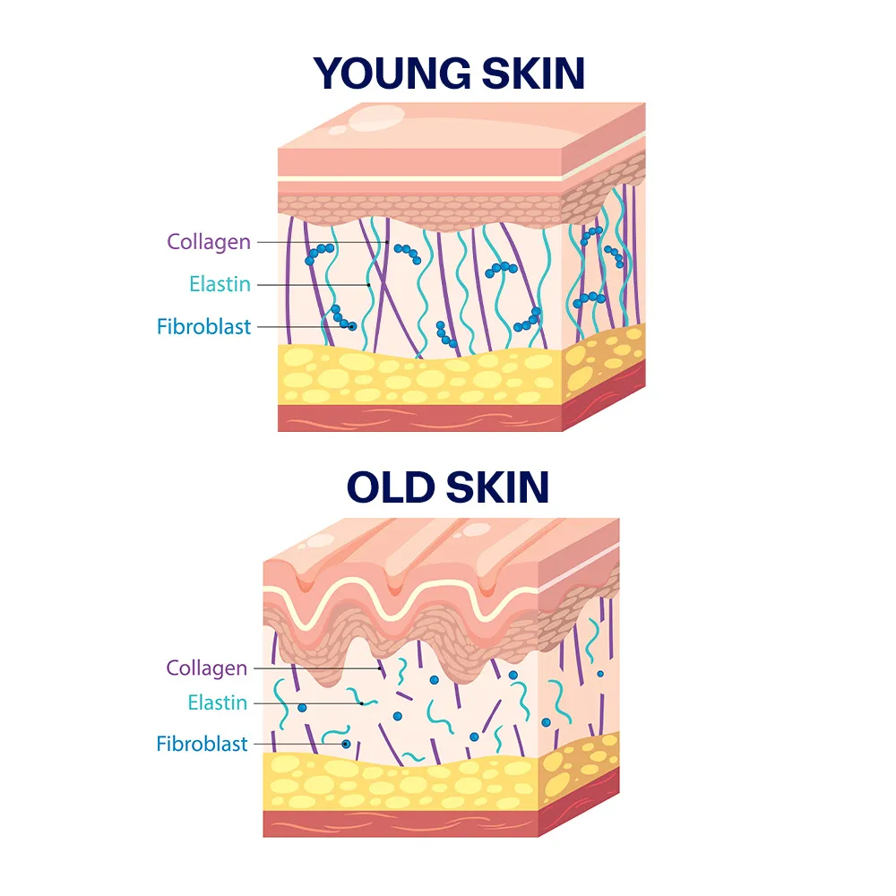 what is skin laxity