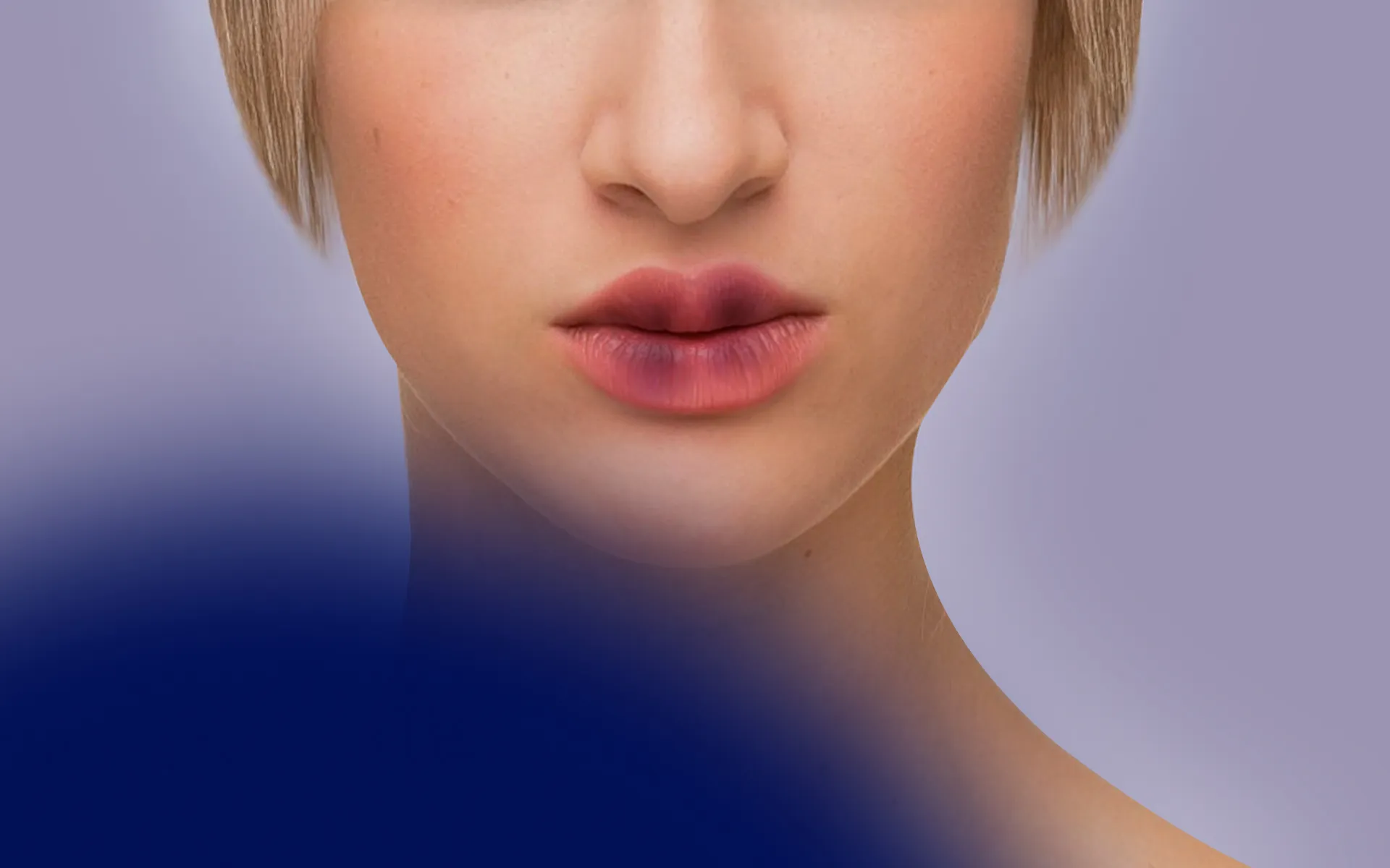  Lip Filler Bruising: Causes, Stages, and Fast Treatments