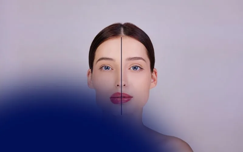 Pillow Face Before and After Examples
