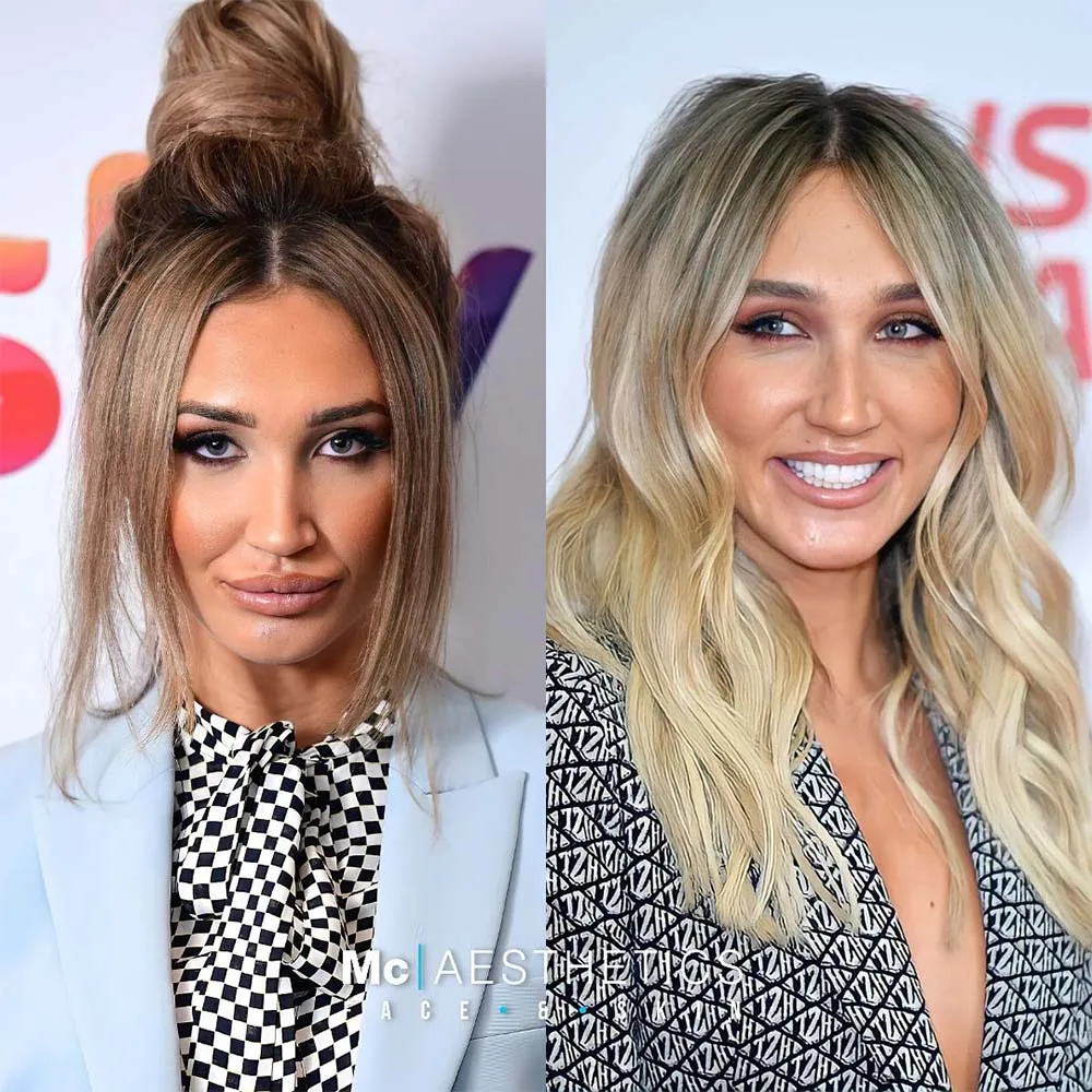Pillow Face Before and After Images