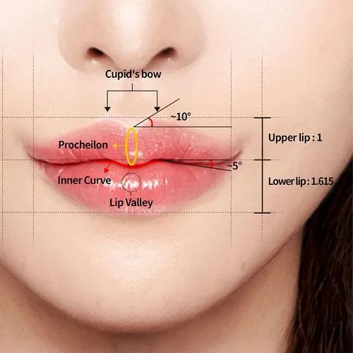 Korean Lip Filler Technique