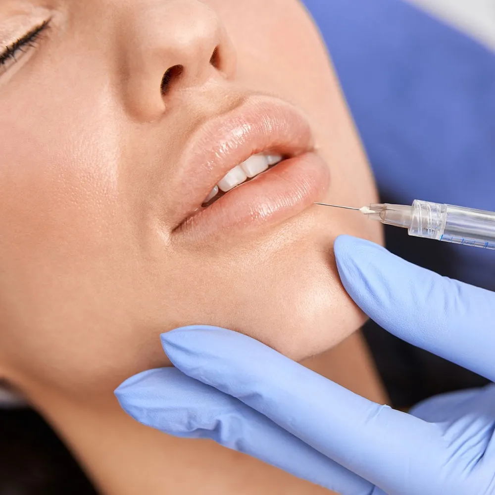 Natural Lip Filler