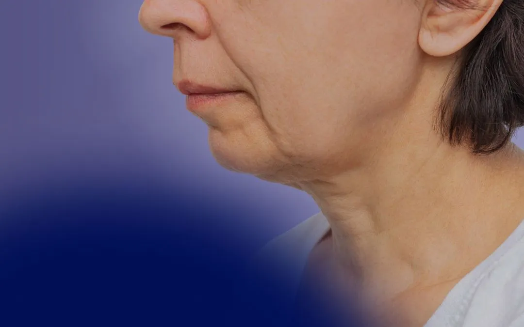 What Are Sagging Jowls: Causes + Best Treatment Options For Sagging Jowls