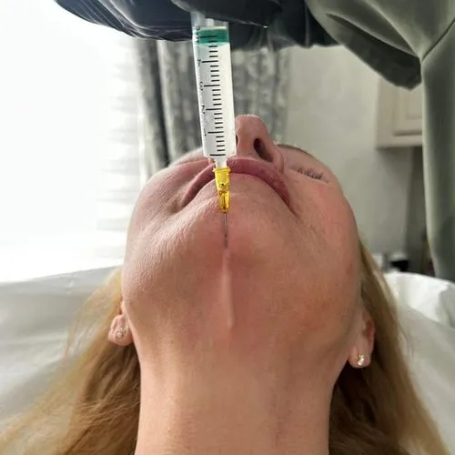 Best Treatment for Skin Laxity Sculptra