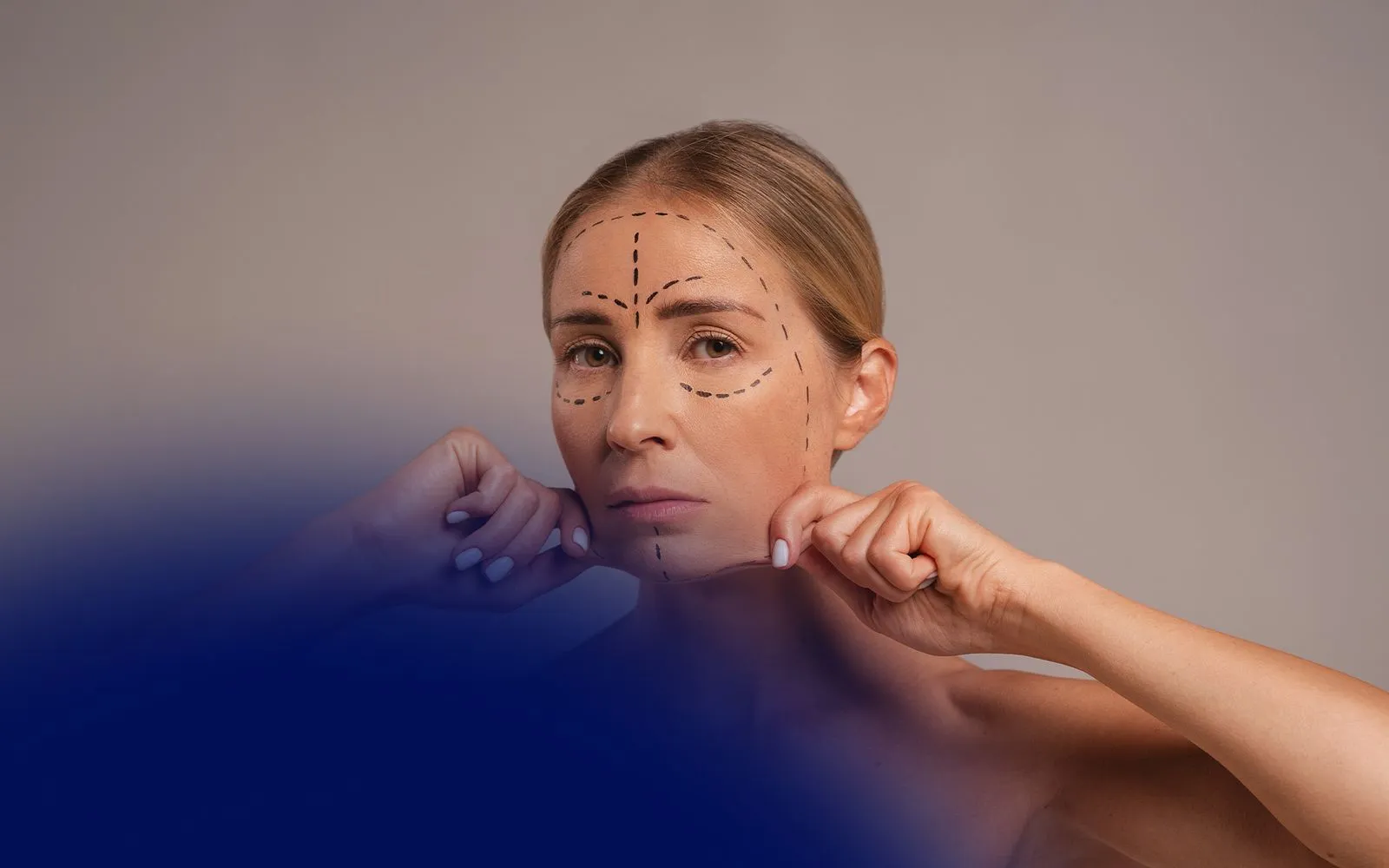 Cutting Edge Techniques for Effective Treatment of Skin Laxity