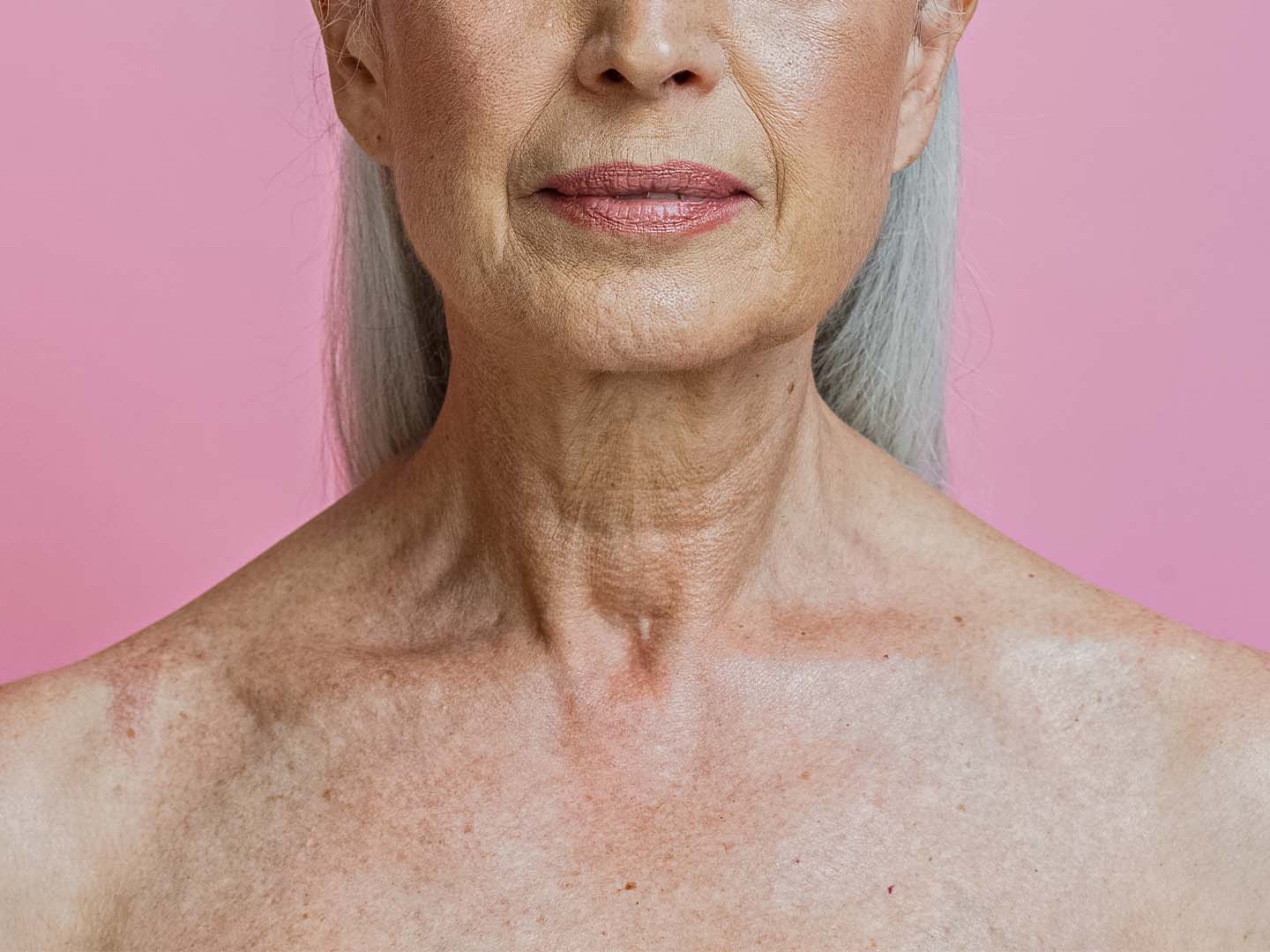 Crepey Neck Skin Treatment: Best Solutions for Smoother Skin