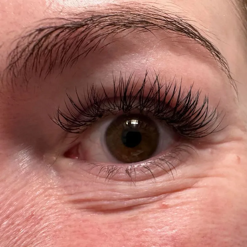 under eye crepey skin treatment