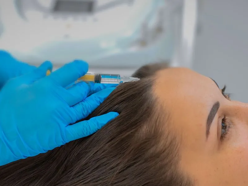 PRP for Hair Loss: Treatment Process and Expected Results