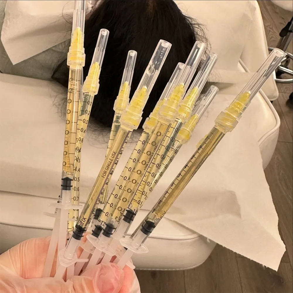 prp for hair loss