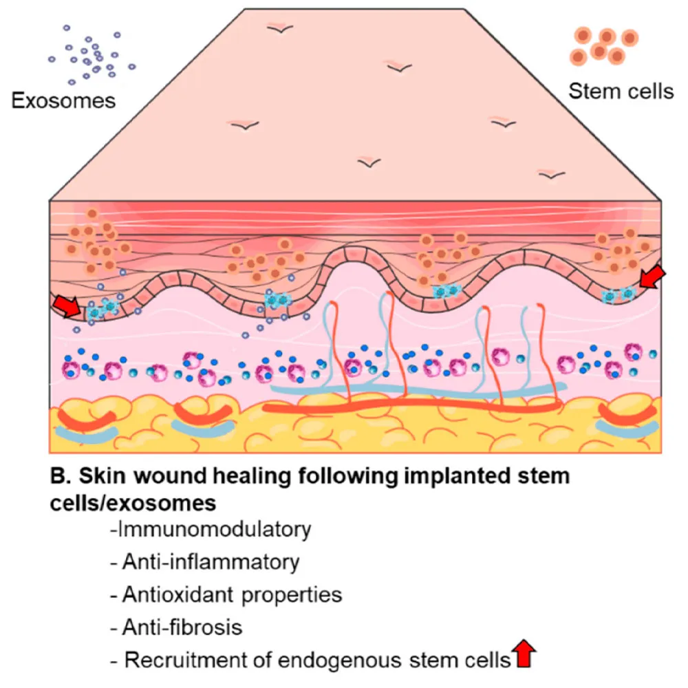 exosomes vs stem cells