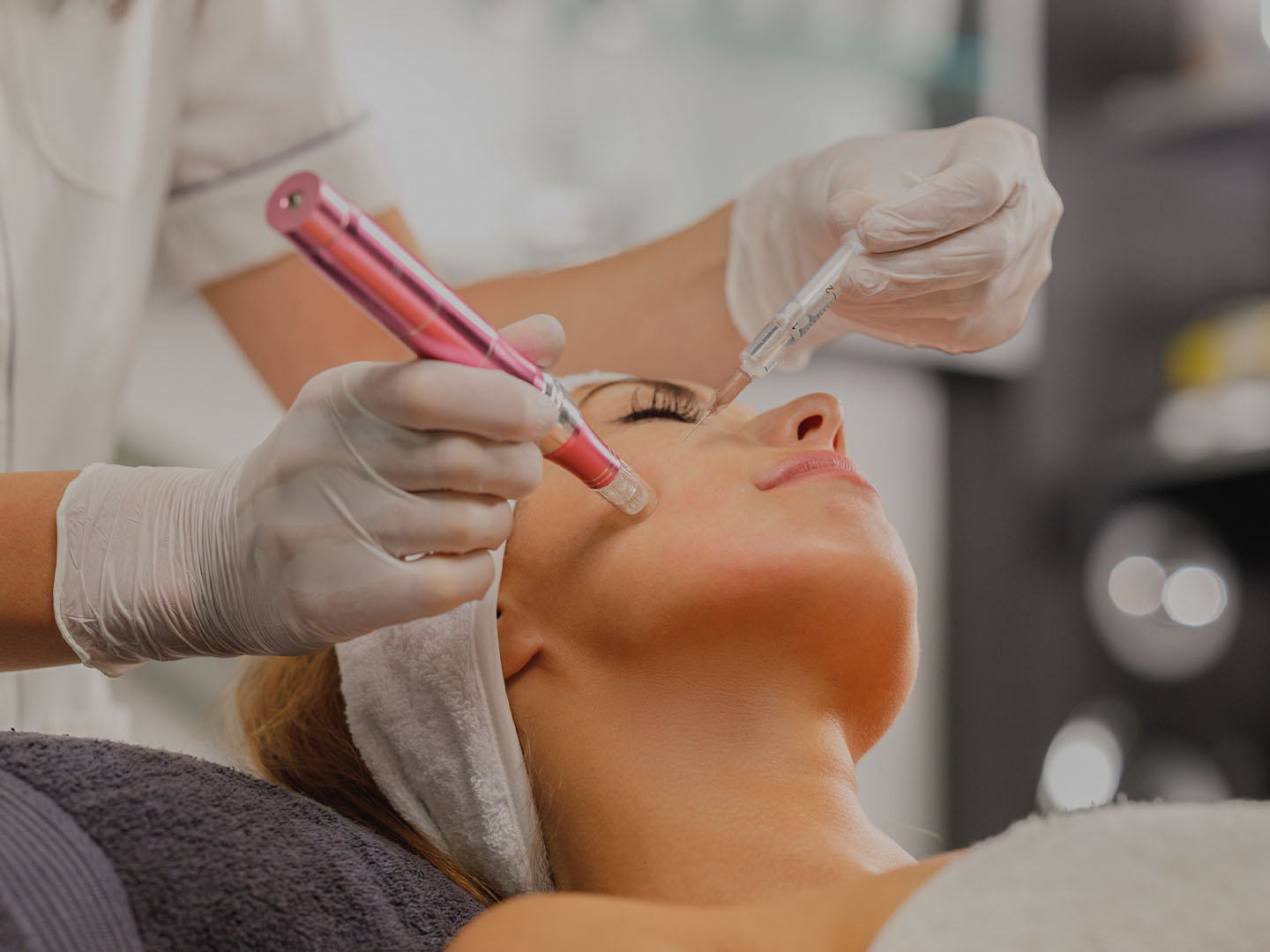 Microneedling with Exosomes Before and After Results