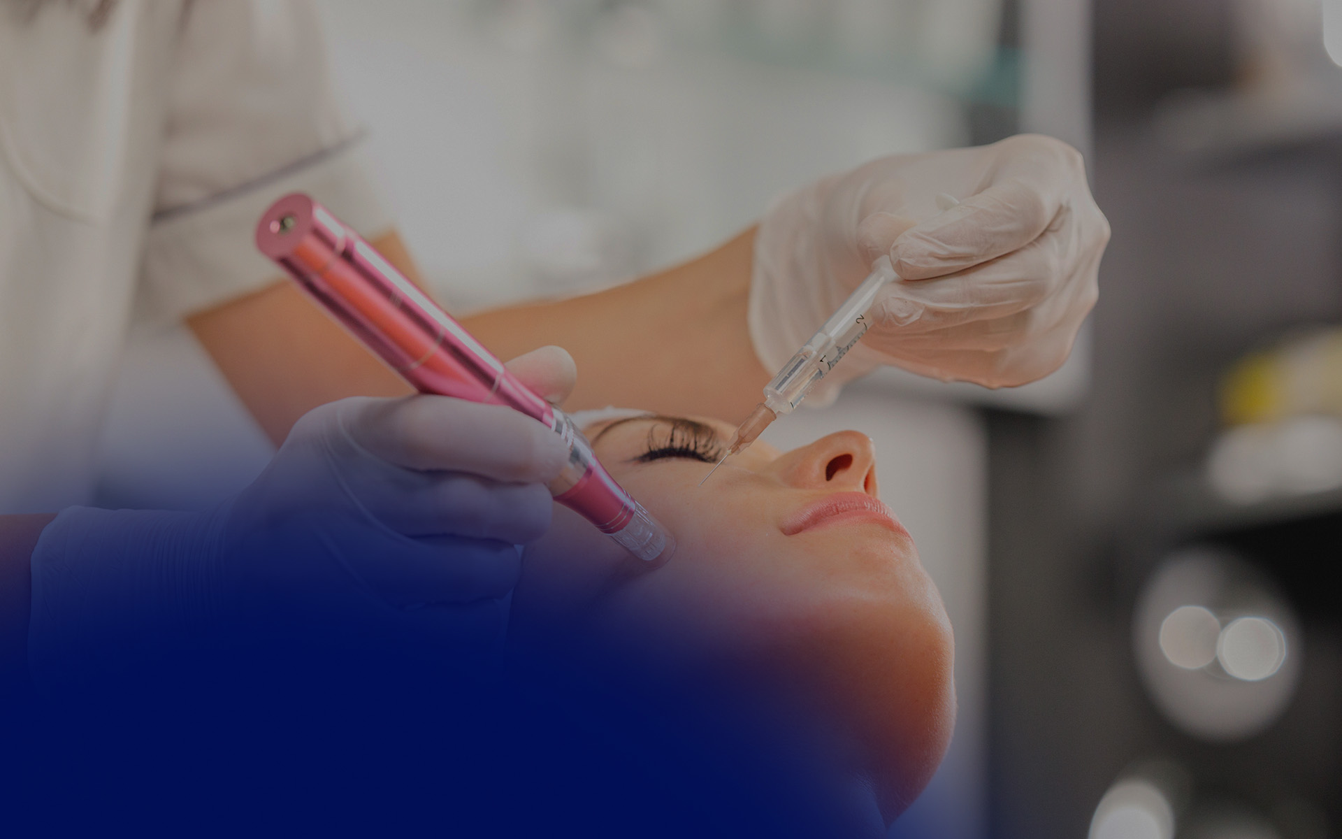 Microneedling with Exosomes Before and After Results