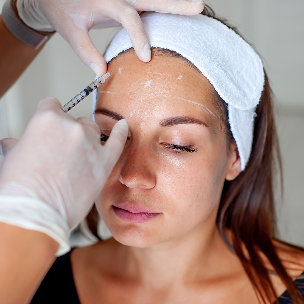 botox forehead injection sites