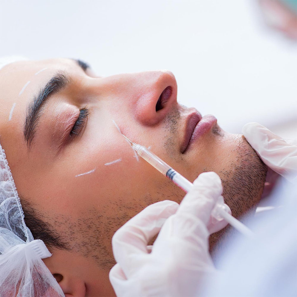 Men Cheek Filler