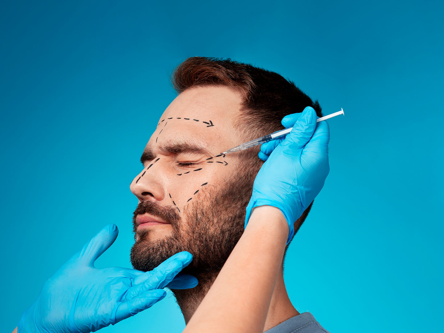 Botox for Men: Clinical Techniques and Gender-Specific Aesthetic Goals