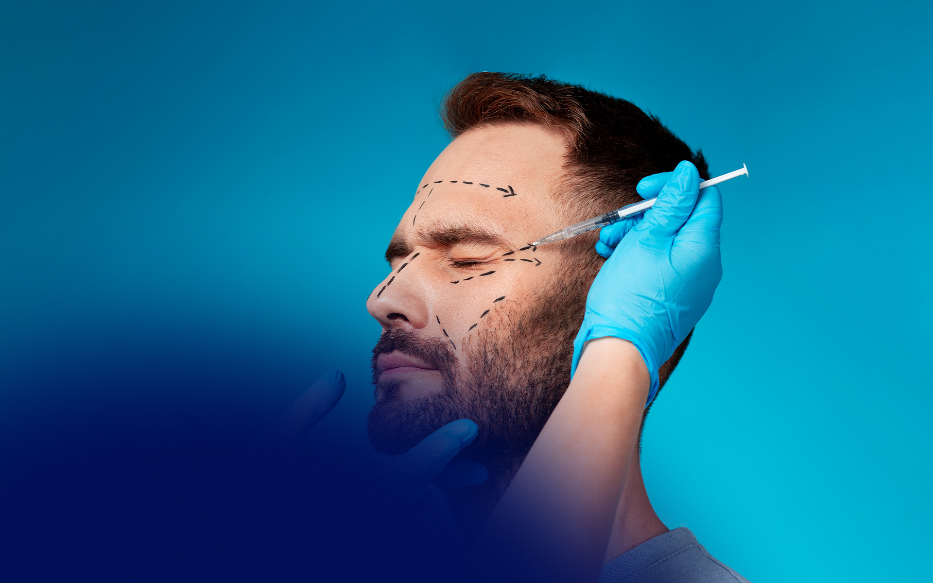 Botox for Men: Clinical Techniques and Gender-Specific Aesthetic Goals