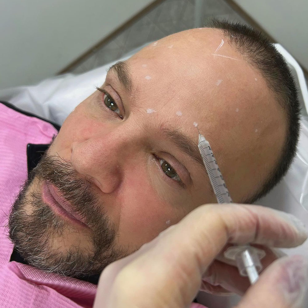 Botox for men