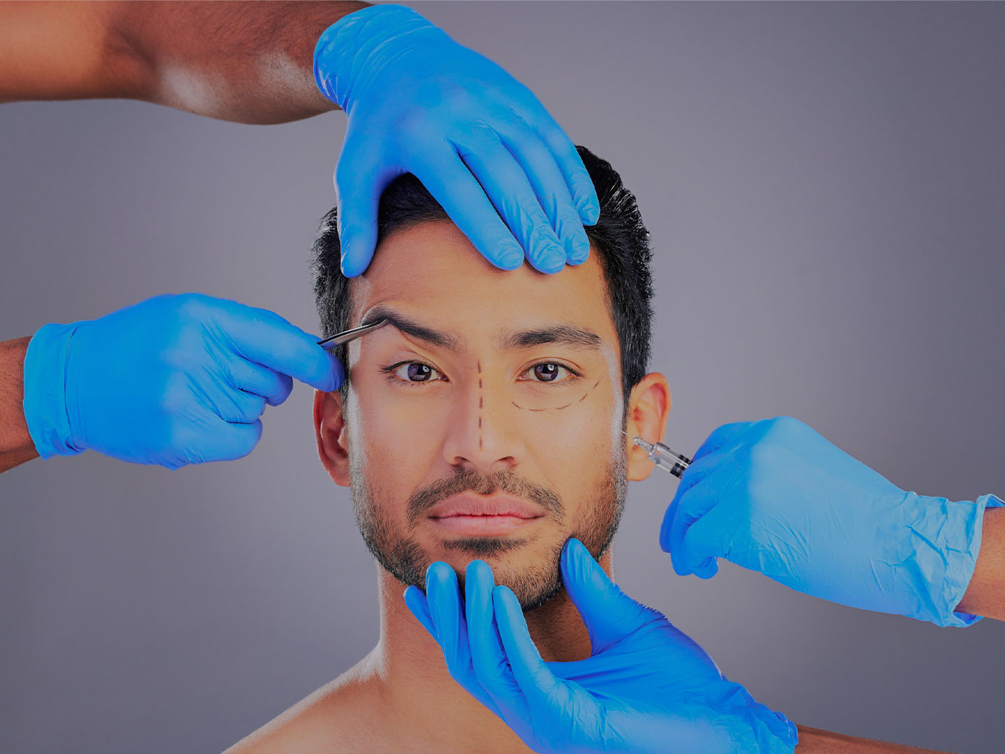 Facial Masculinization Fillers: Sculpting Masculine Features Non-Surgically