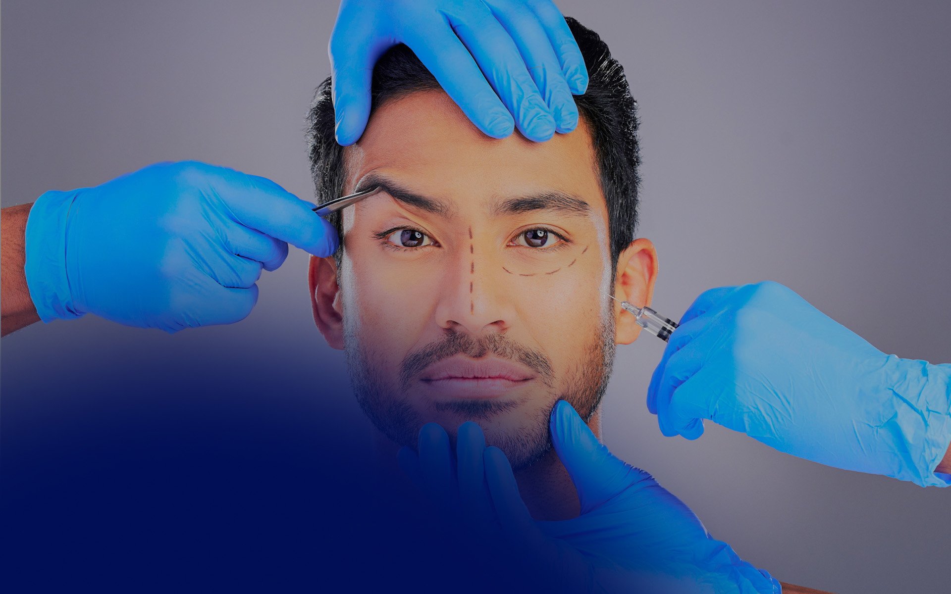 Facial Masculinization Fillers: Sculpting Masculine Features Non-Surgically