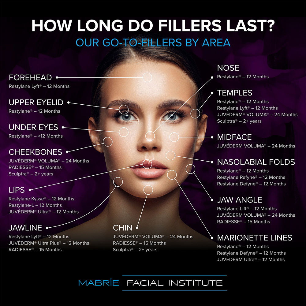how long does juvederm last