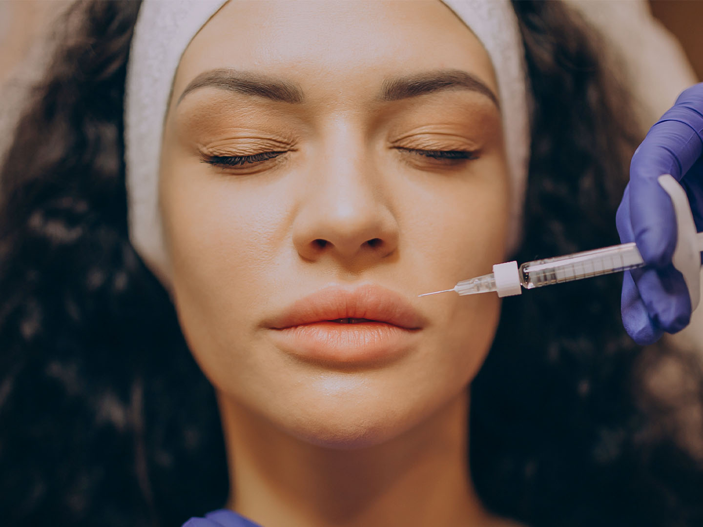 Lip Augmentation with Juvéderm: Tailoring Treatment by Lip Type and Patient Profile