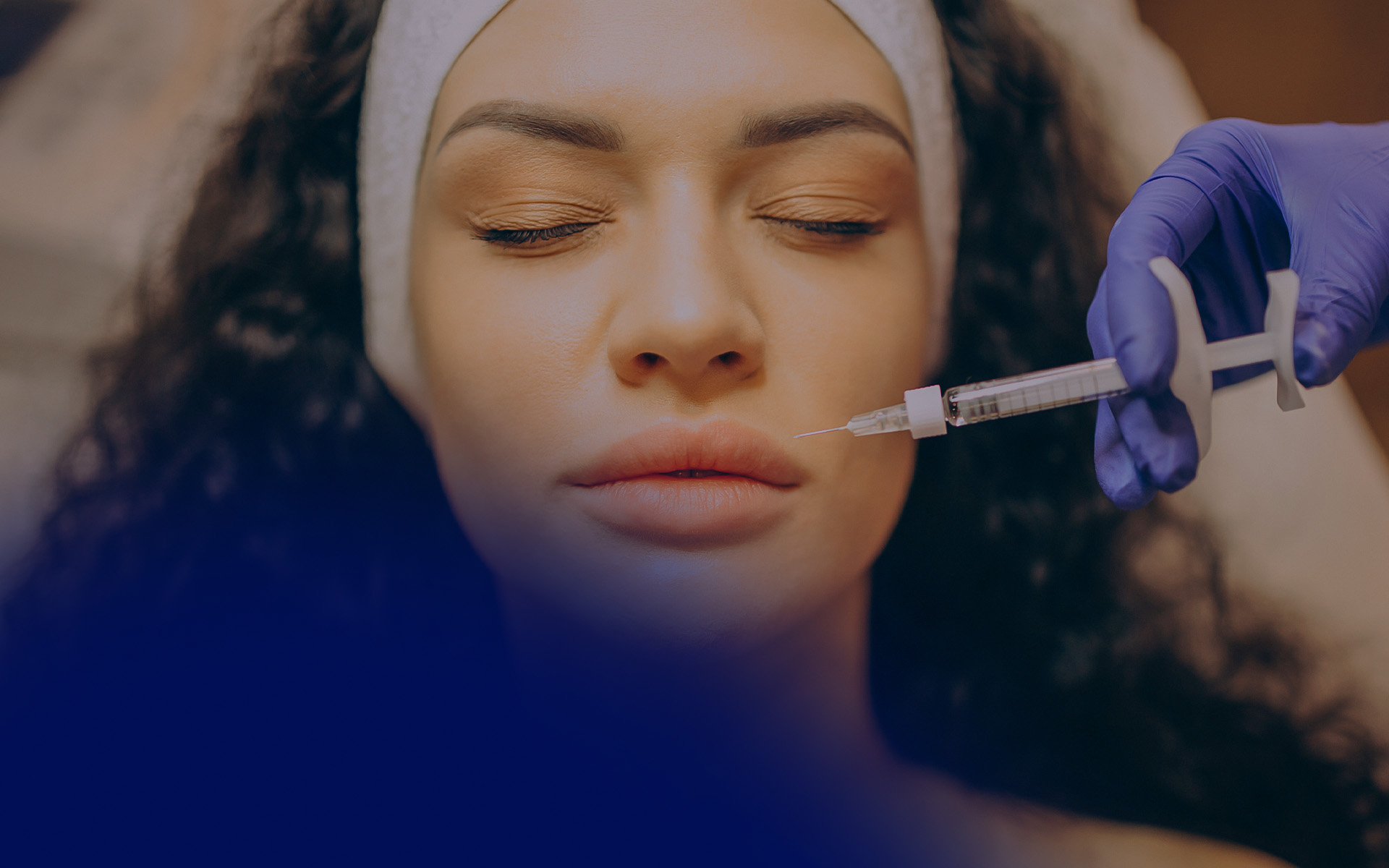 Lip Augmentation with Juvéderm: Tailoring Treatment by Lip Type and Patient Profile