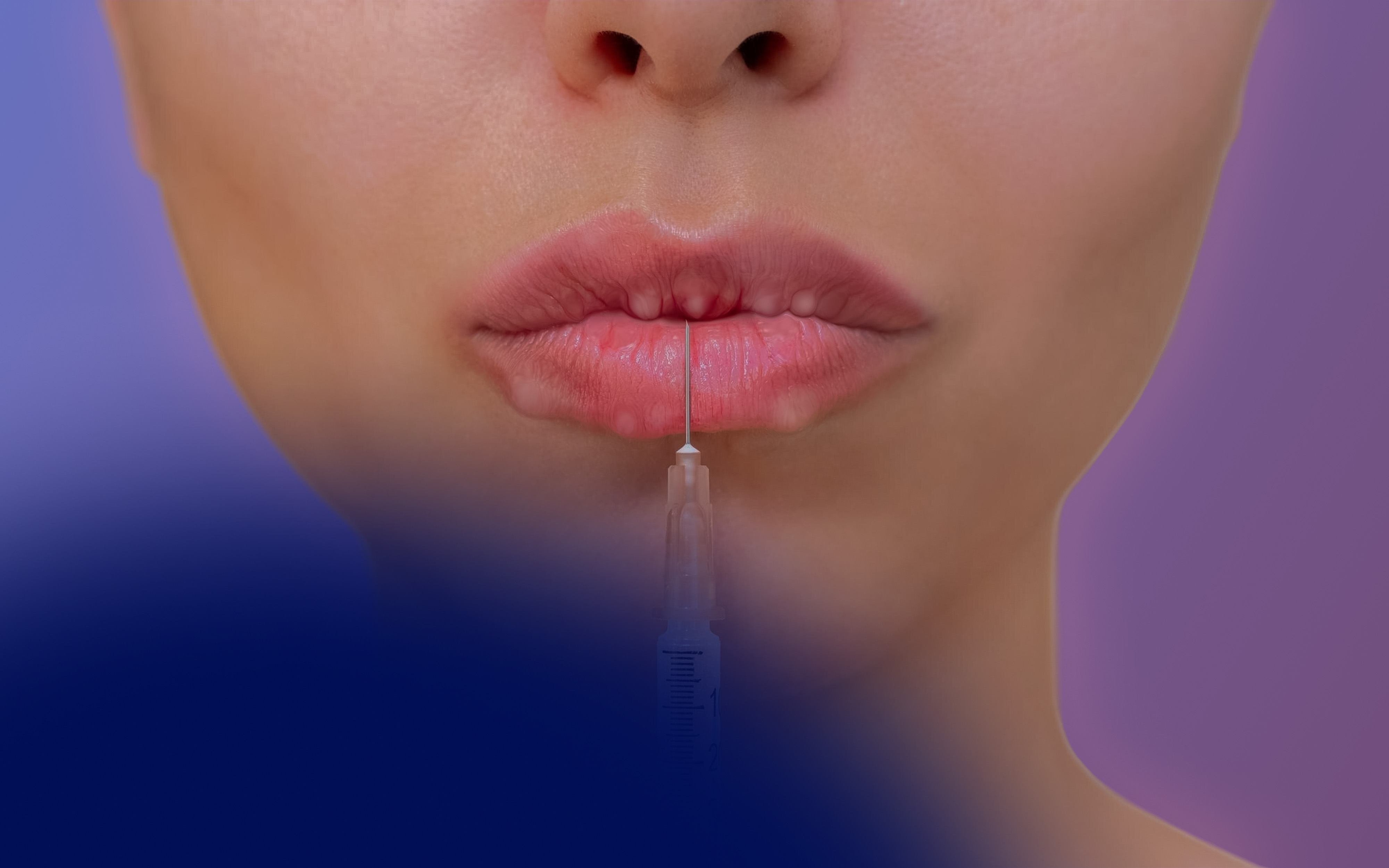 Lip Filler Lumps Months Later: Causes, Risks, and Treatment Options