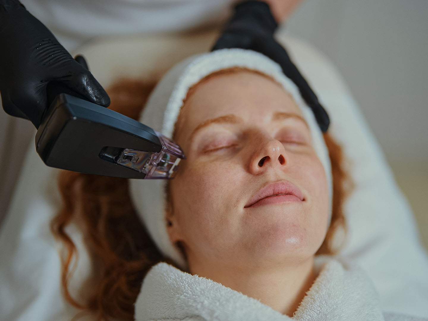 Microneedling with Sculptra Before and After: Clinical Benefits, Protocols, and Patient Outcomes