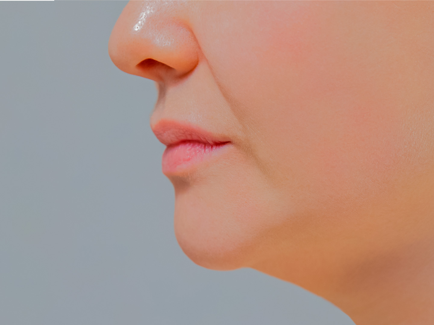 Smoothing Nasolabial Folds: How Juvederm Works in This Key Area