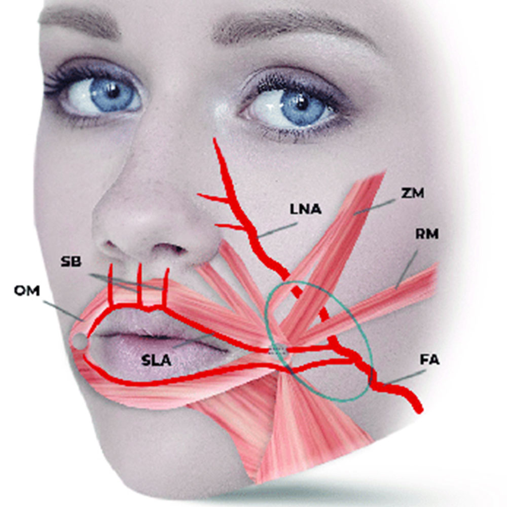juvederm nasolabial folds