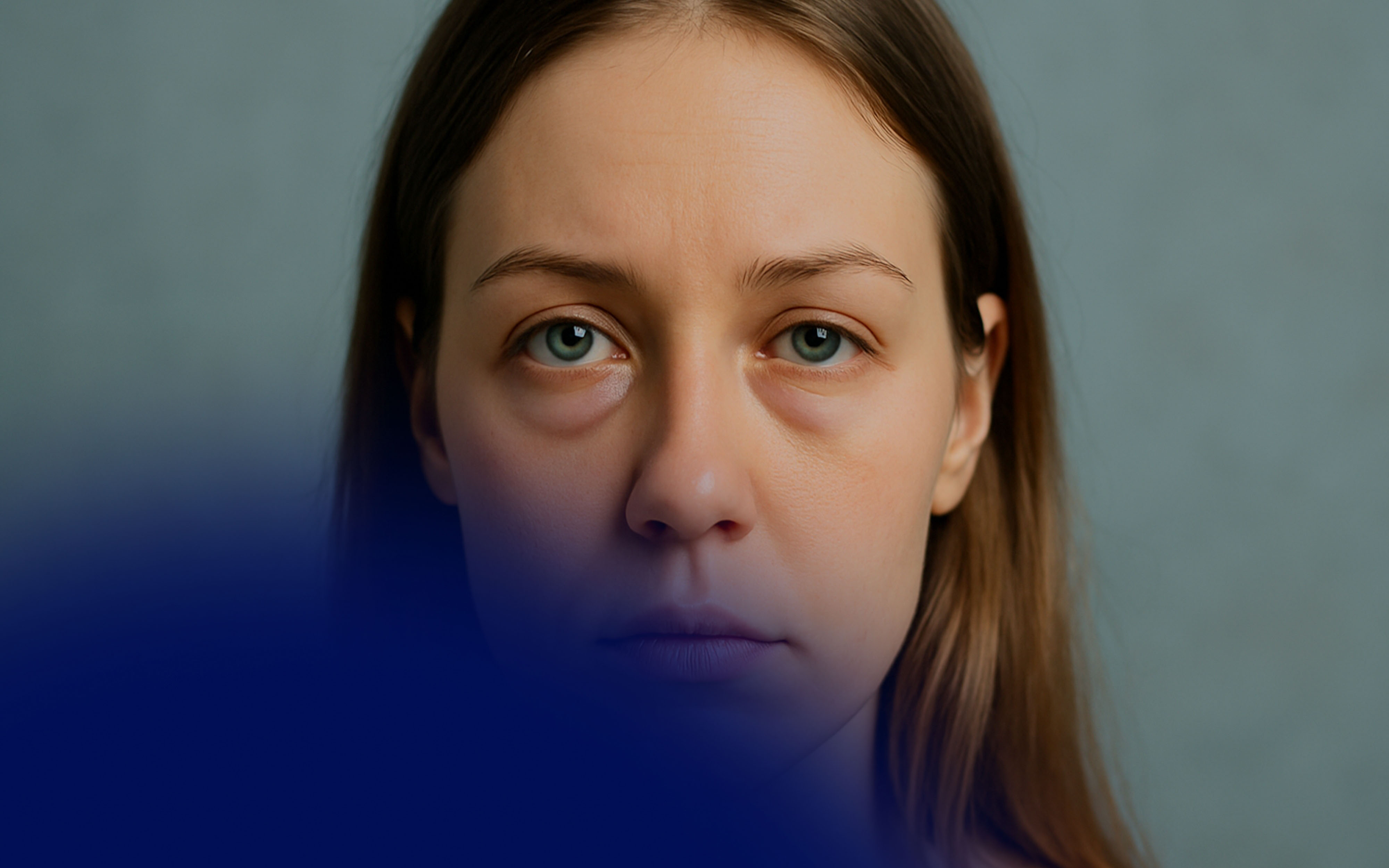 Under Eye Fillers Gone Wrong: Causes, Corrections, and Case Studies