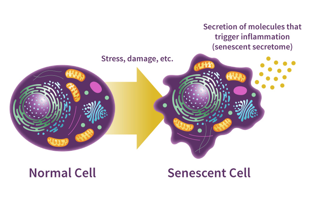 normal cell vs senescent cell
