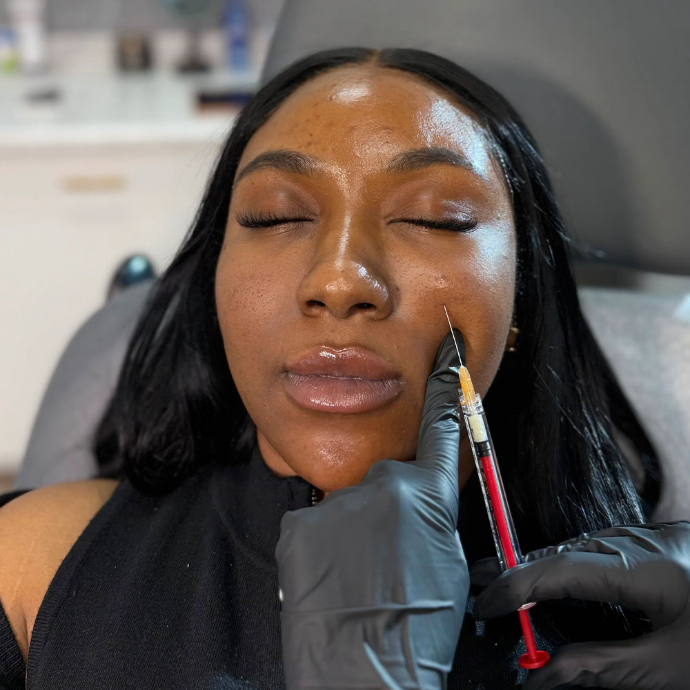 prf ez gel under eye treatment