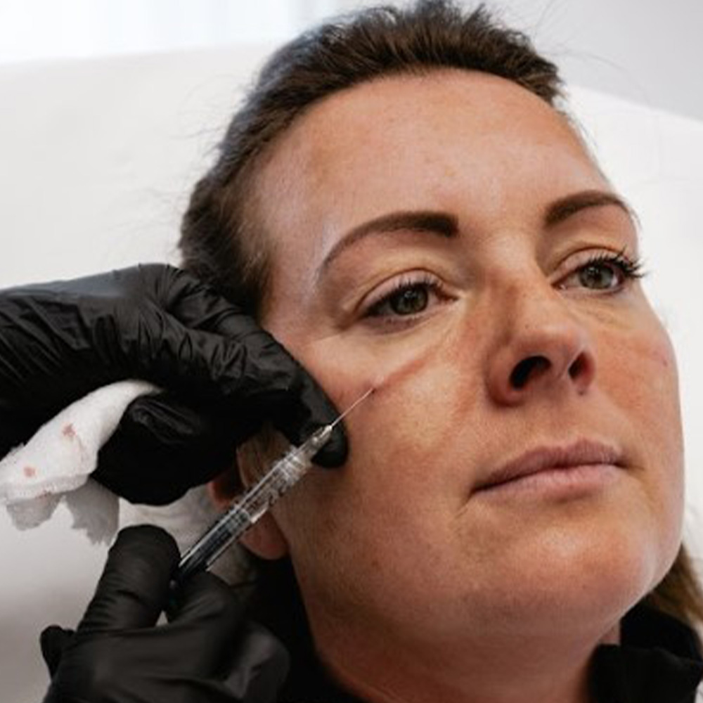 Is Under Eye Filler Safe