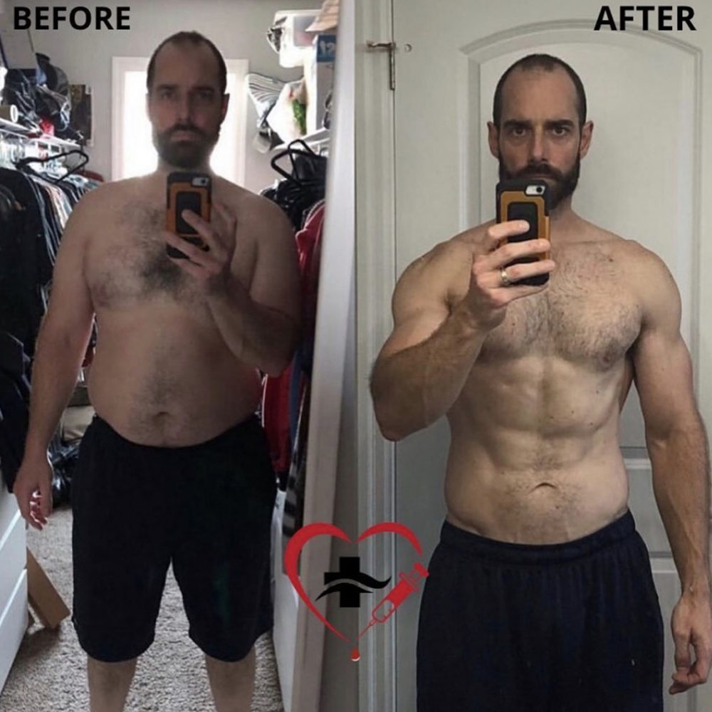 mic b12 injections before and after in man