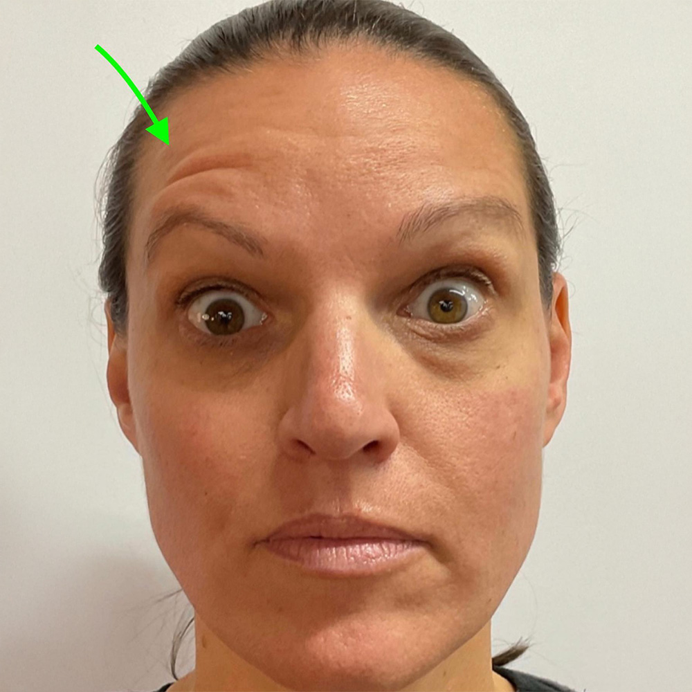 what is spock brow