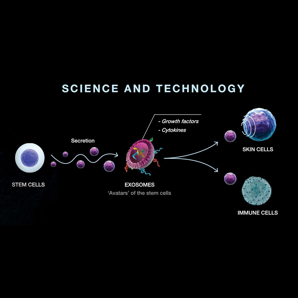 exosomes vs stem cells