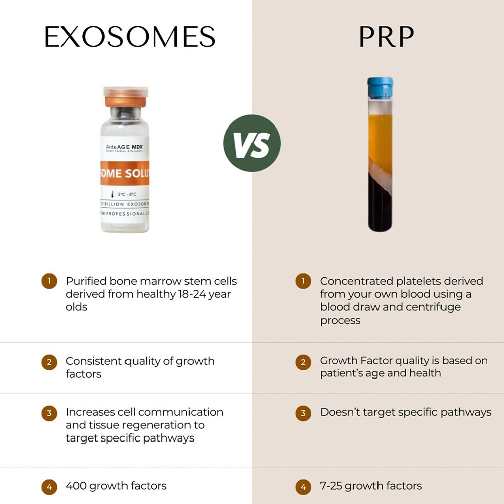 exosomes vs prp