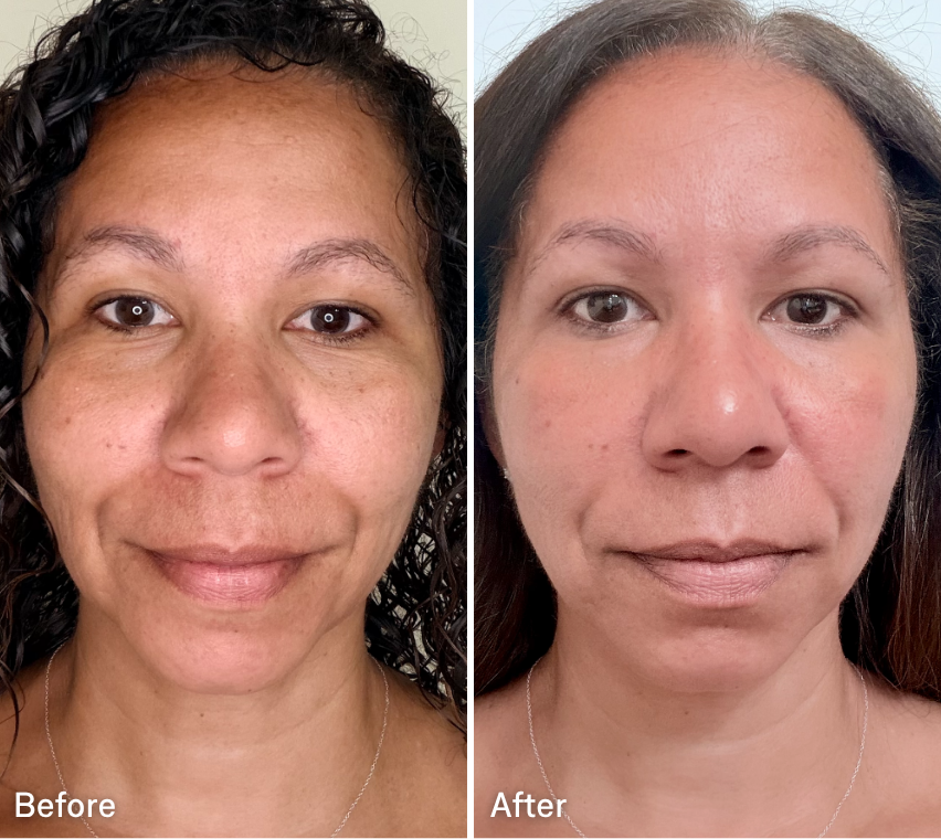 Omnilux Contour Face LED Device